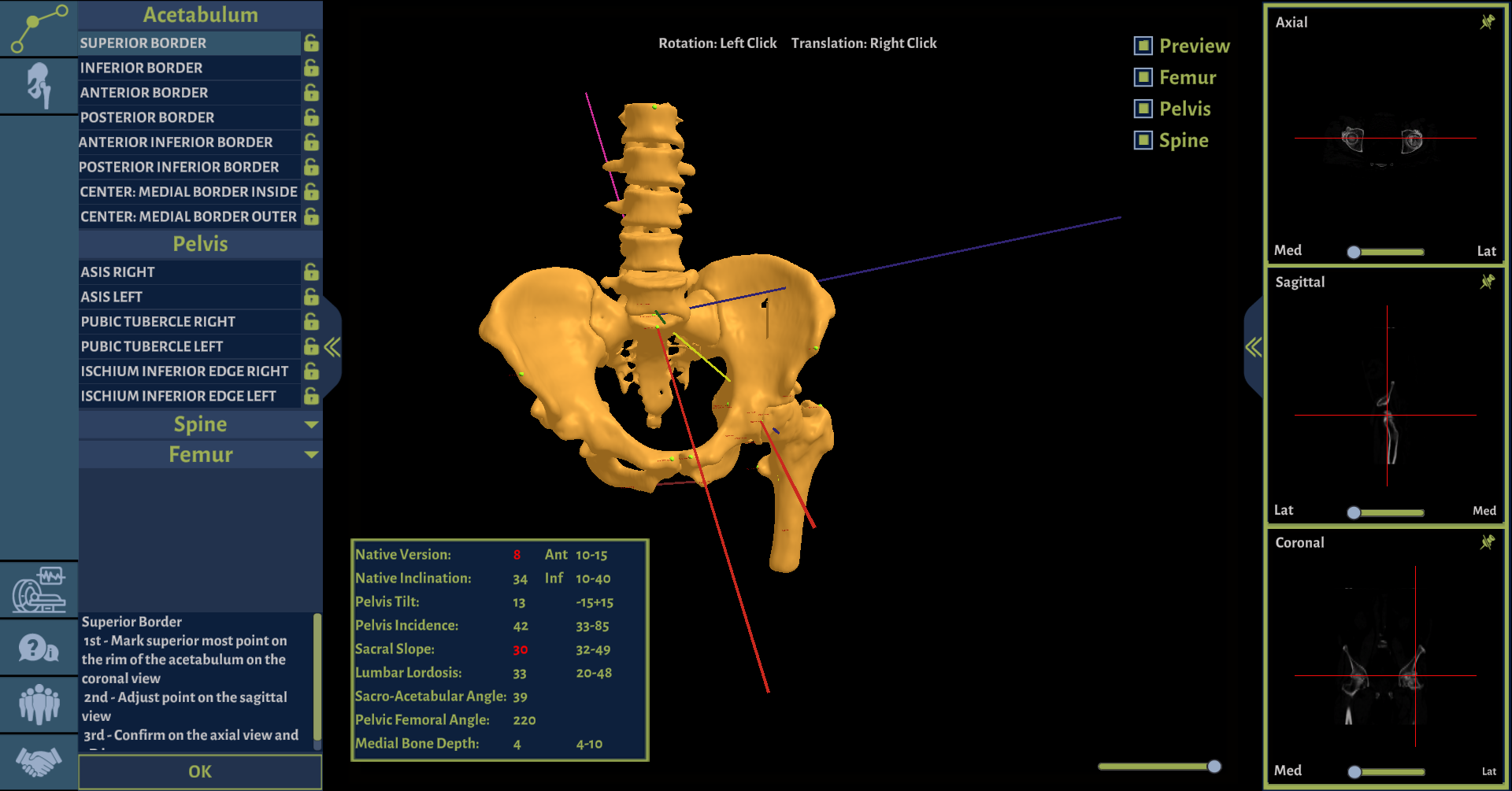 Surgical Landmarks with 3D Robotics